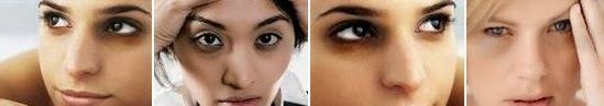 El problema de las ojeras 2 El problema de las ojeras 1