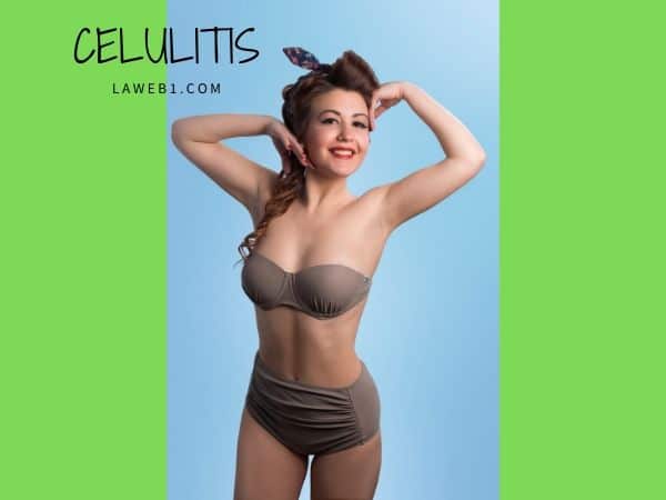 La verdad de la celulitis y cómo combatirla 2 La verdad de la celulitis y cómo combatirla